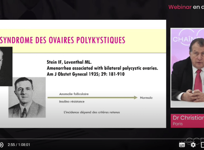 webinar SOPK
